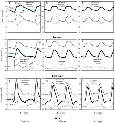 Acute Tachycardia Increases Aortic Distensibility, but Reduces Total Arterial Compliance Up to a Moderate Heart Rate